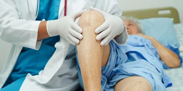 Top 10 Common Myths and Facts About Knee Replacement Surgery