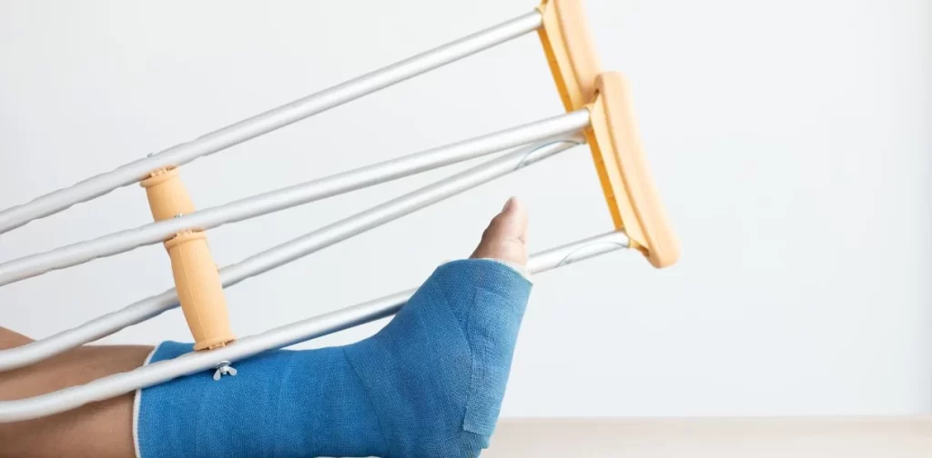 fracture trauma